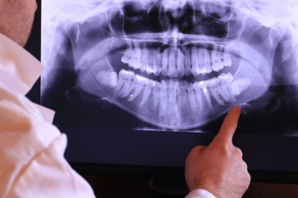 Best Emergency Gum Treatment in Oakland, NE
