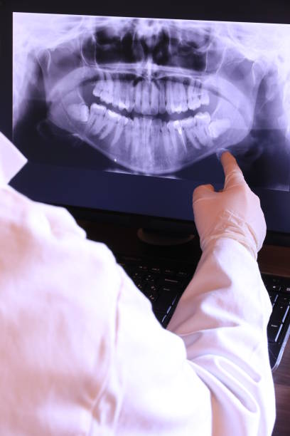 Best Emergency Tooth Extraction in Oakland, NE