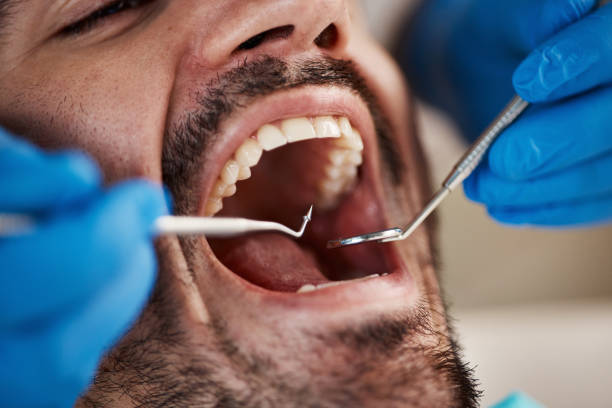 Best Emergency Treatment for Dental Infections or Abscesses in Oakland, NE